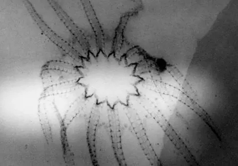 Fossilienankauf_Bundenbach_Röntgen Fossilienankauf_Bundenbach_Röntgen